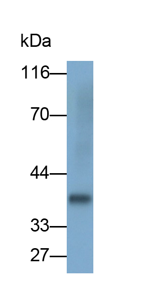 Monoclonal Antibody to Carbonic Anhydrase IV (CA4)