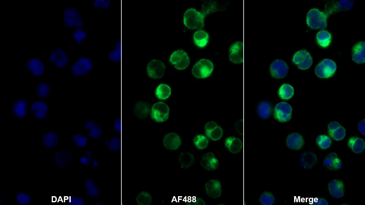 Monoclonal Antibody to T-Cell Surface Glycoprotein CD3 Gamma (CD3g)