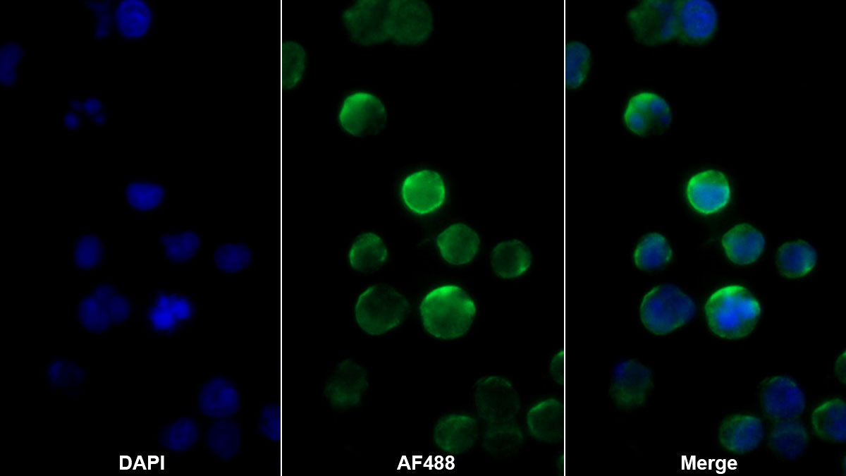 Monoclonal Antibody to T-Cell Surface Glycoprotein CD3 Gamma (CD3g)