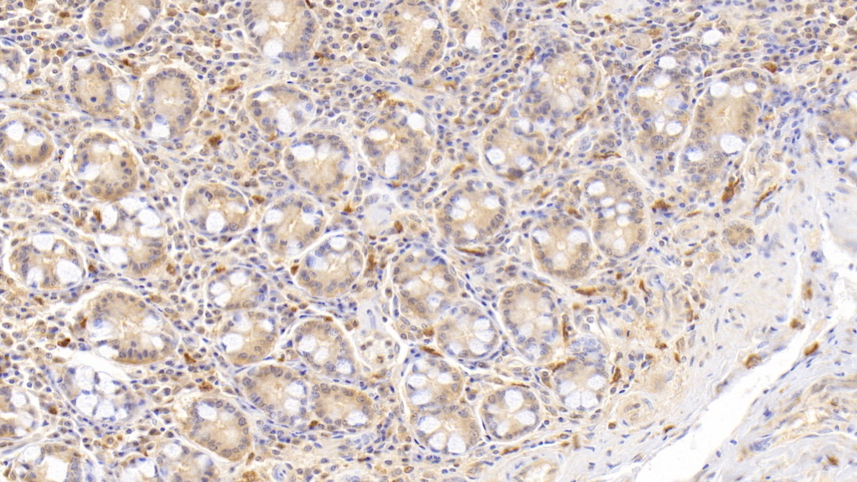 Monoclonal Antibody to Ribonuclease A2 (RNASE2)