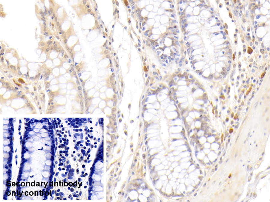 Monoclonal Antibody to Ribonuclease A2 (RNASE2)