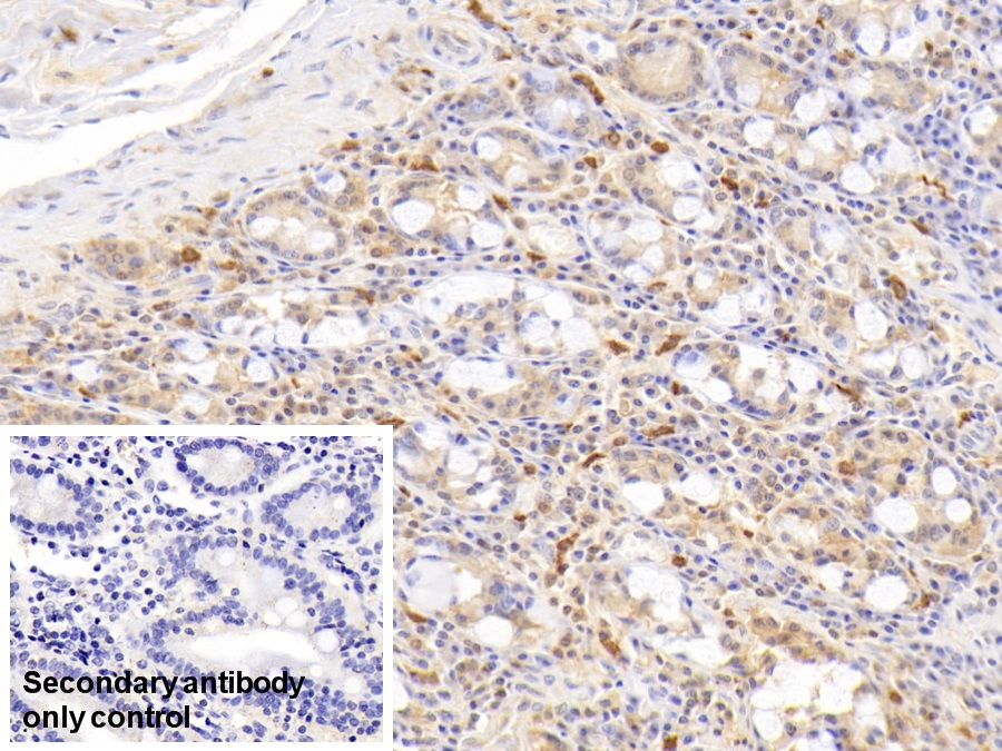 Monoclonal Antibody to Ribonuclease A2 (RNASE2)