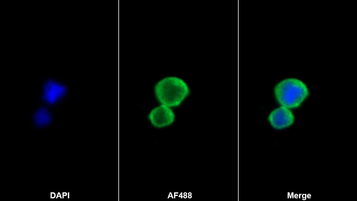 Monoclonal Antibody to Ribonuclease A2 (RNASE2)