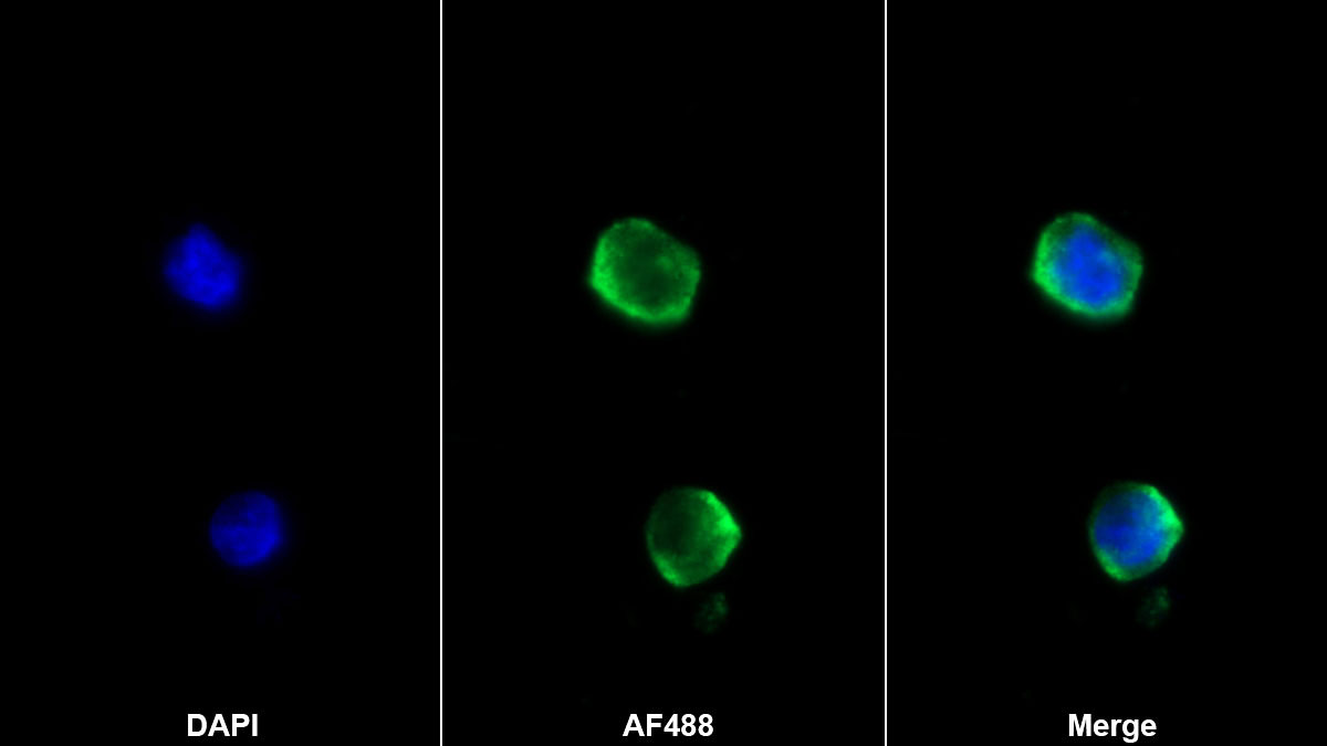 Monoclonal Antibody to Ribonuclease A2 (RNASE2)