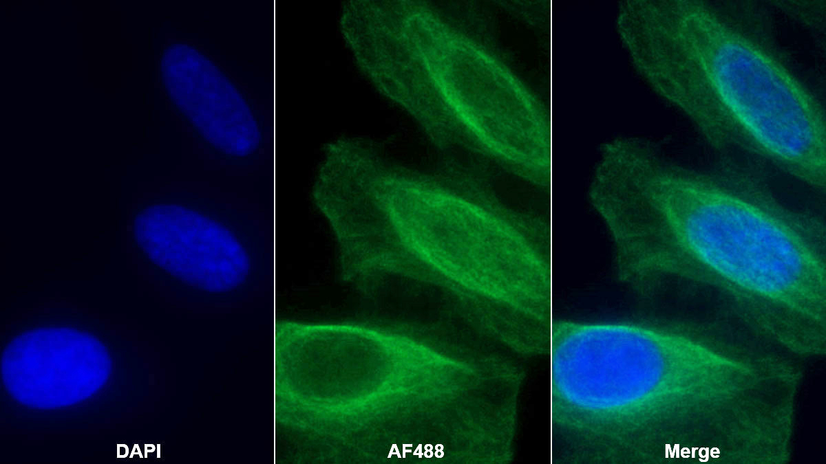 Monoclonal Antibody to Collagen Type III Alpha 1 (COL3a1)