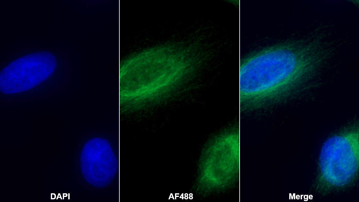 Monoclonal Antibody to Collagen Type III Alpha 1 (COL3a1)