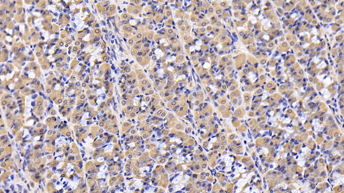 Monoclonal Antibody to Sequestosome 1 (SQSTM1)