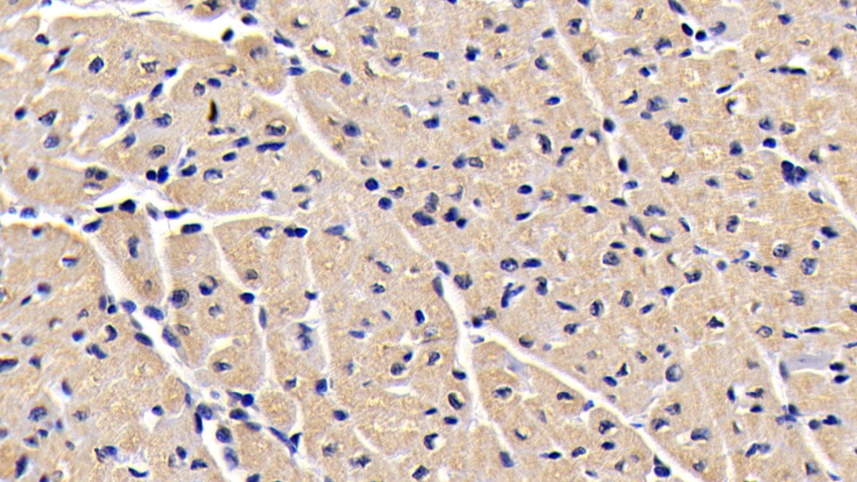 Monoclonal Antibody to Sequestosome 1 (SQSTM1)