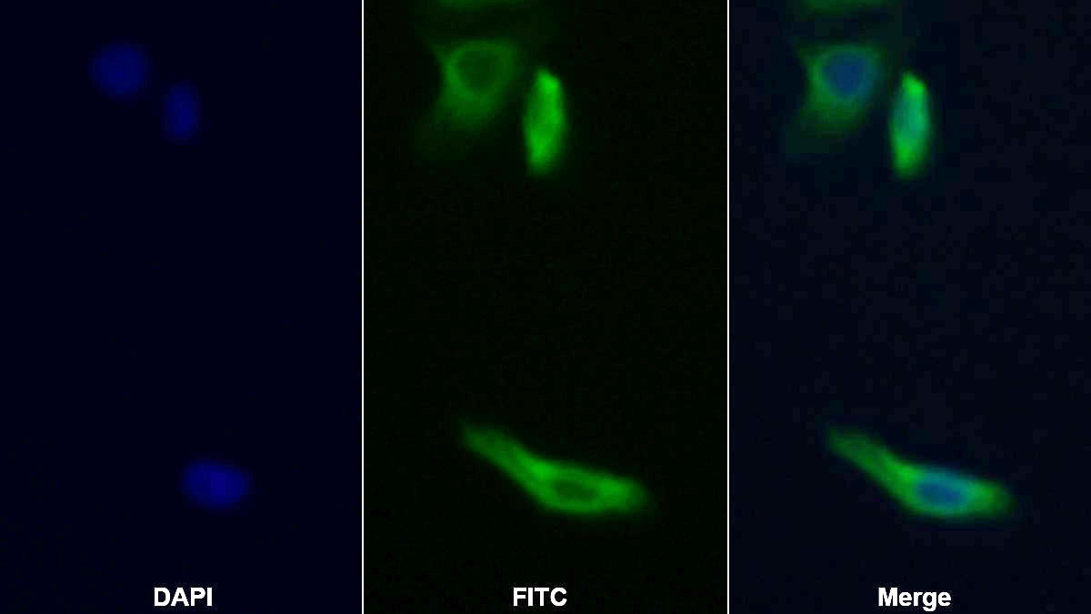 Monoclonal Antibody to Sequestosome 1 (SQSTM1)