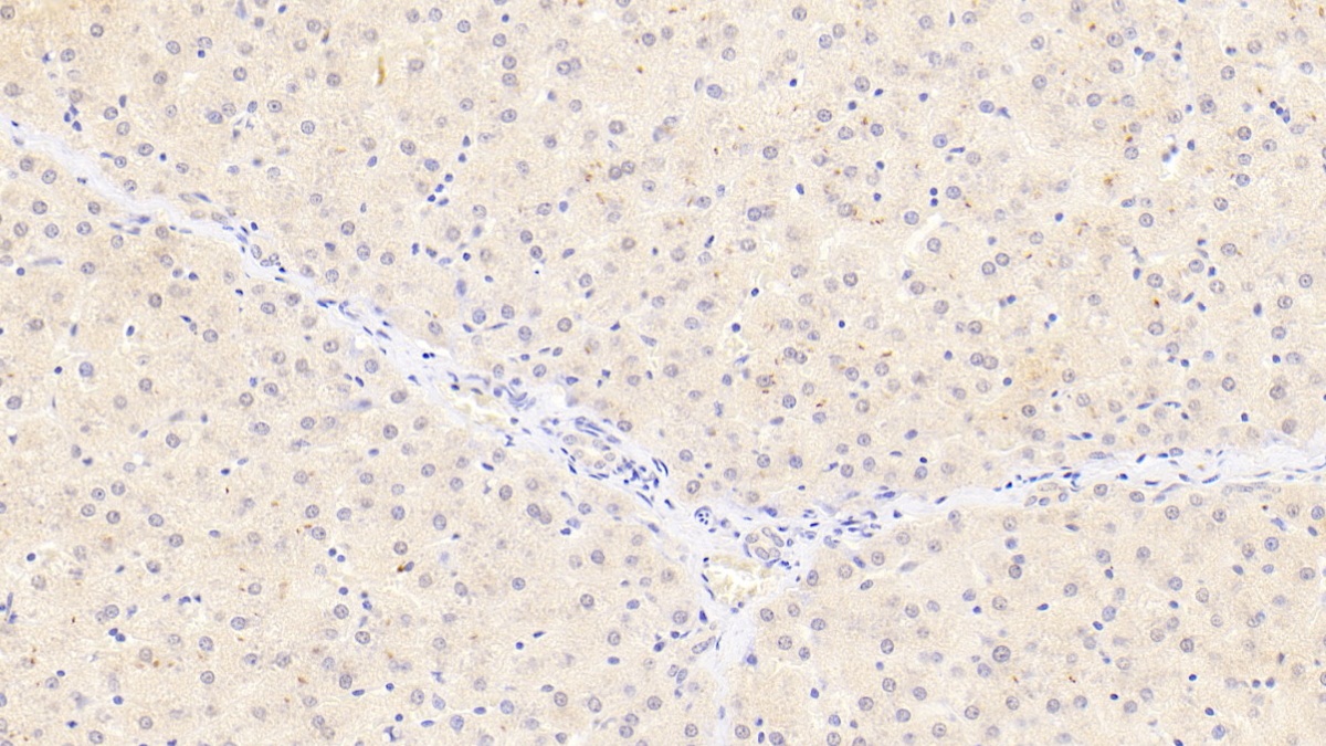 Monoclonal Antibody to Lipase, Monoacylglycerol (MGL)