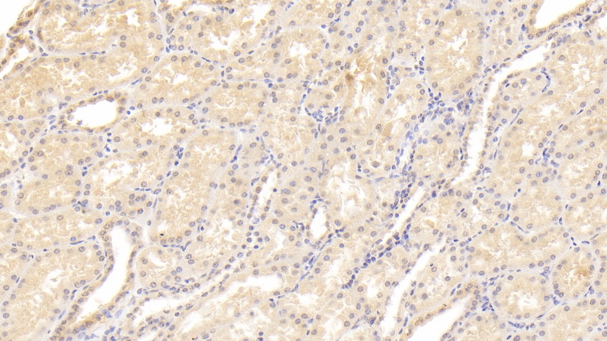 Monoclonal Antibody to Lipase, Monoacylglycerol (MGL)