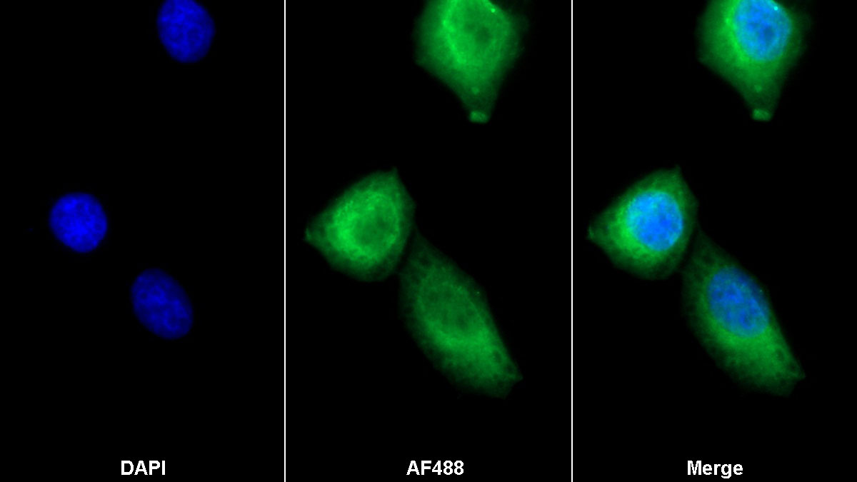 Monoclonal Antibody to Troponin C Type 1, Slow (TNNC1)