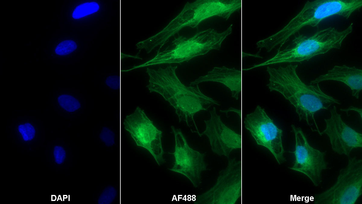 Monoclonal Antibody to Troponin C Type 1, Slow (TNNC1)