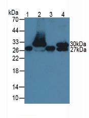 Monoclonal Antibody to Troponin I Type 1, Slow Skeletal (TNNI1)