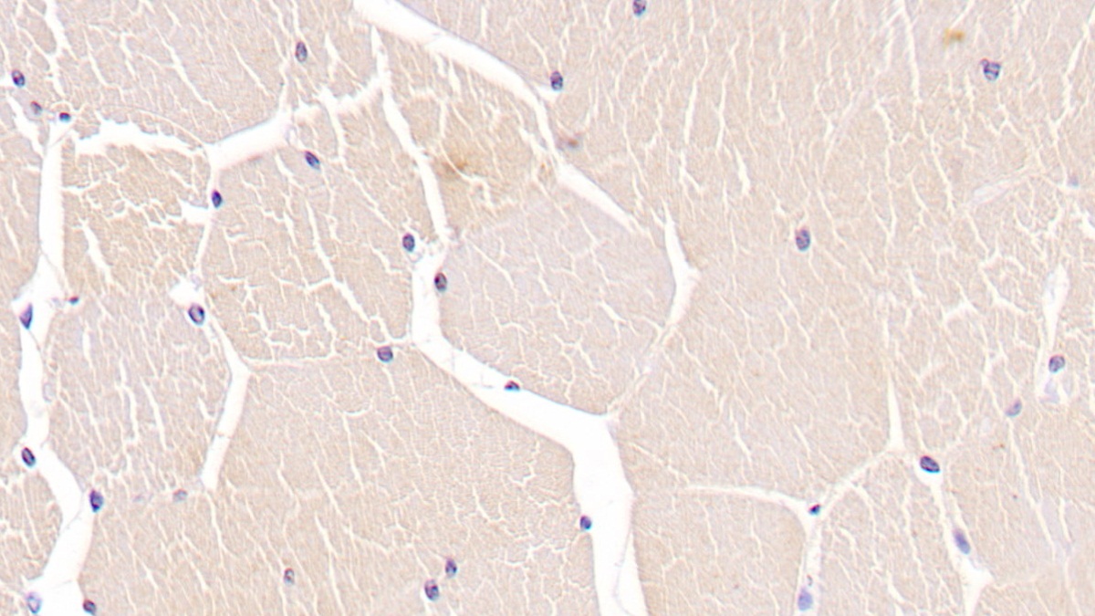 Monoclonal Antibody to Troponin T Type 2, Cardiac (TNNT2)