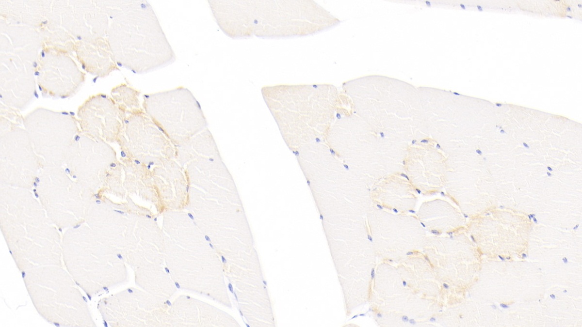 Monoclonal Antibody to Troponin T Type 2, Cardiac (TNNT2)