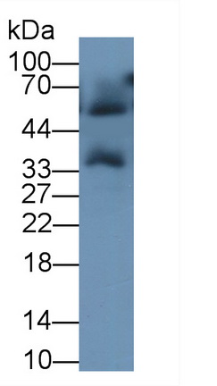 Monoclonal Antibody to Troponin T Type 2, Cardiac (TNNT2)