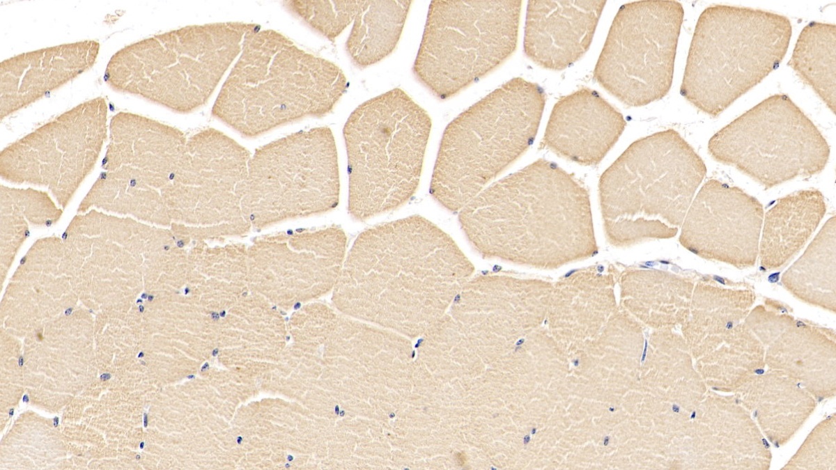 Monoclonal Antibody to Troponin T Type 2, Cardiac (TNNT2)