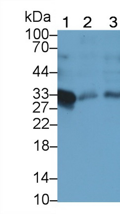 Monoclonal Antibody to Troponin T Type 2, Cardiac (TNNT2)