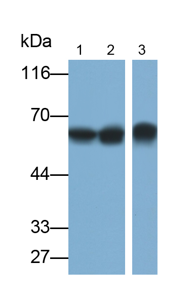 Monoclonal Antibody to Keratin 6A (KRT6A)