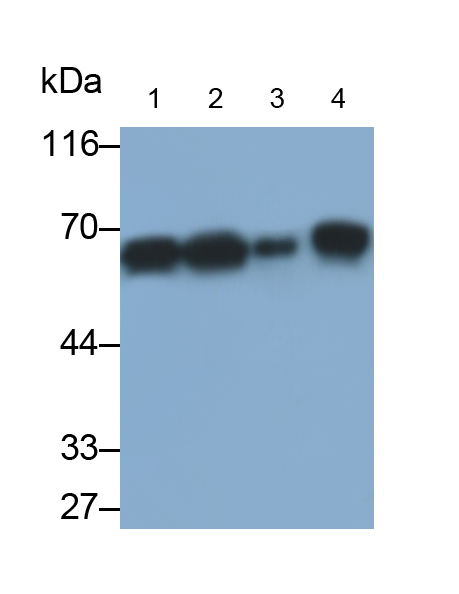 Monoclonal Antibody to Keratin 6A (KRT6A)