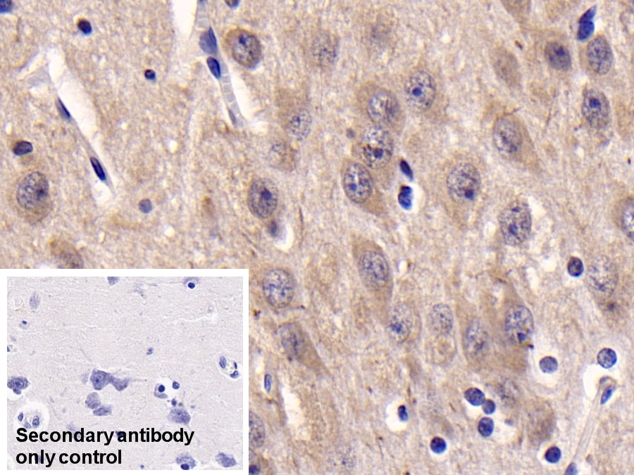 Monoclonal Antibody to Casein Kinase 1 Delta (CSNK1d)