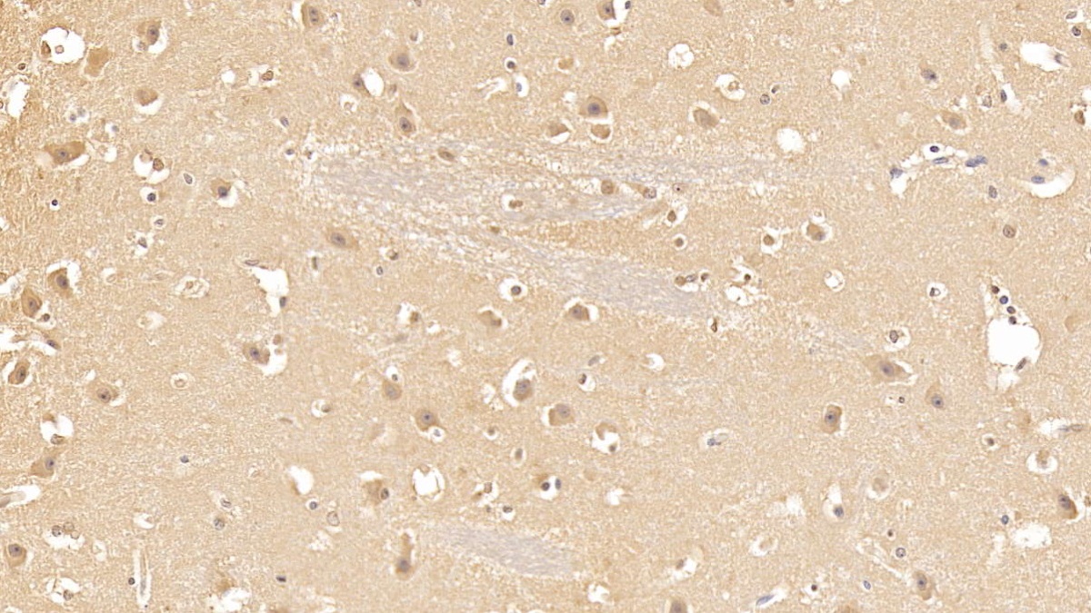 Monoclonal Antibody to Casein Kinase 1 Delta (CSNK1d)