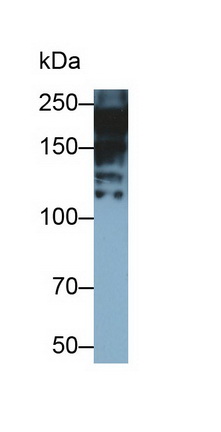 Monoclonal Antibody to Myosin Heavy Chain 7, Cardiac Muscle, Beta (MYH7)