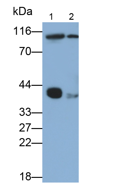 Monoclonal Antibody to Tropomyosin 3 (TPM3)