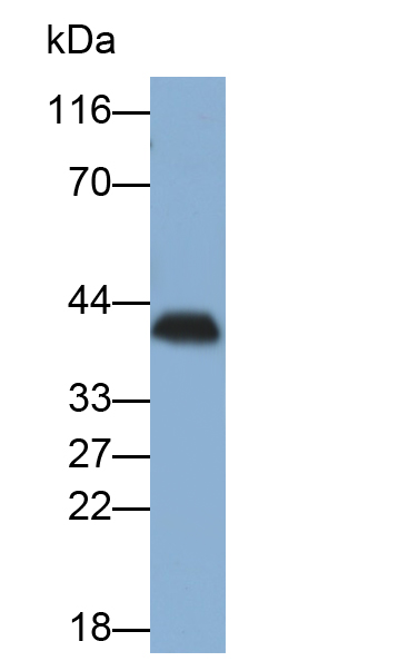 Monoclonal Antibody to Tropomyosin 3 (TPM3)