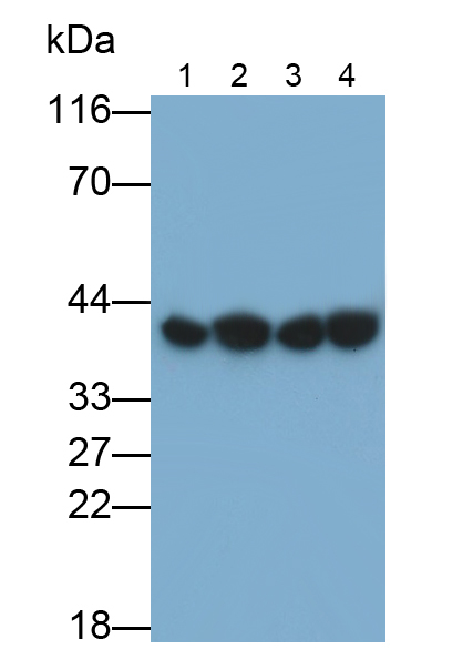 Monoclonal Antibody to Tropomyosin 3 (TPM3)