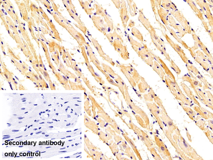 Monoclonal Antibody to Tropomyosin 3 (TPM3)