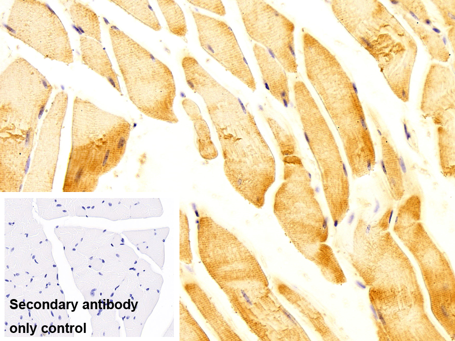 Monoclonal Antibody to Tropomyosin 3 (TPM3)