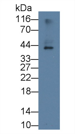 Monoclonal Antibody to Apolipoprotein L2 (APOL2)