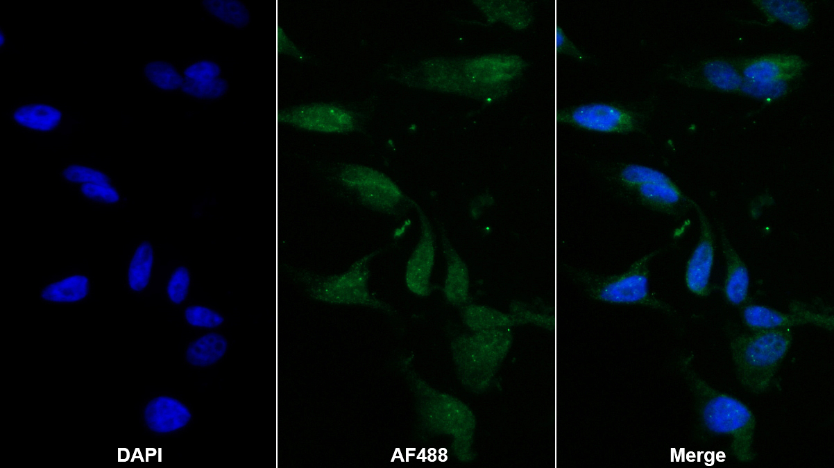 Monoclonal Antibody to Apolipoprotein L2 (APOL2)