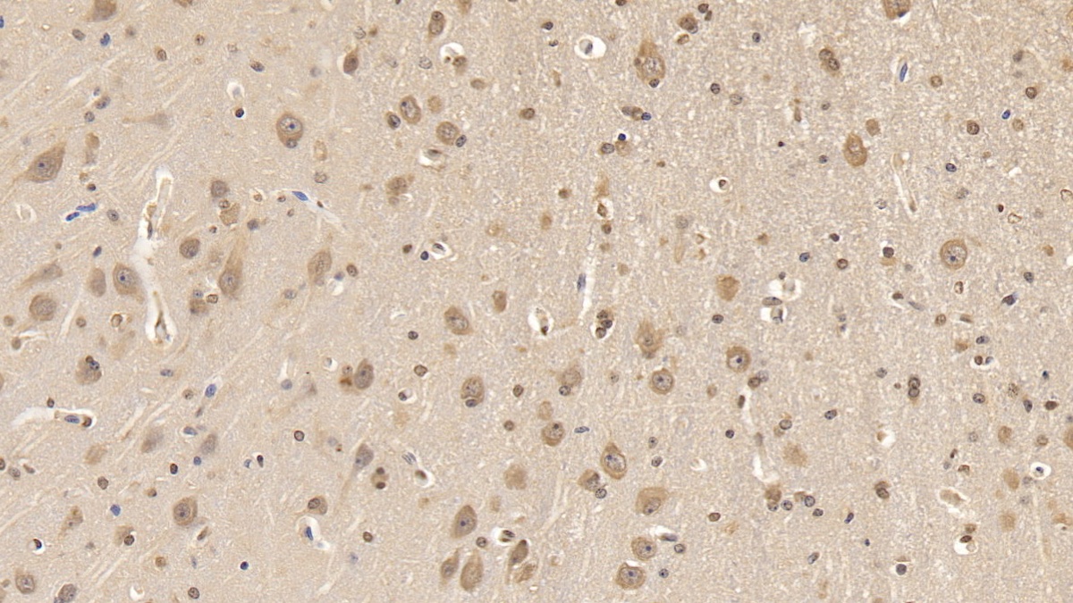 Monoclonal Antibody to Apolipoprotein L2 (APOL2)