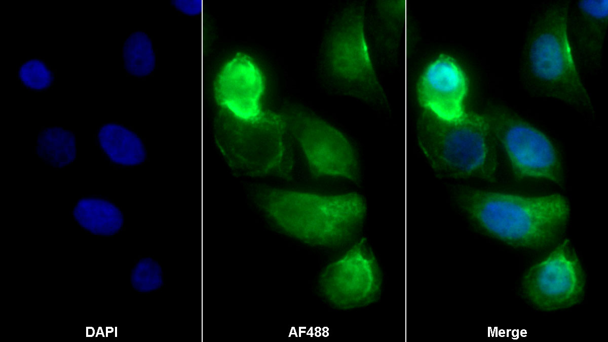 Monoclonal Antibody to ATP Binding Cassette Transporter A3 (ABCA3)