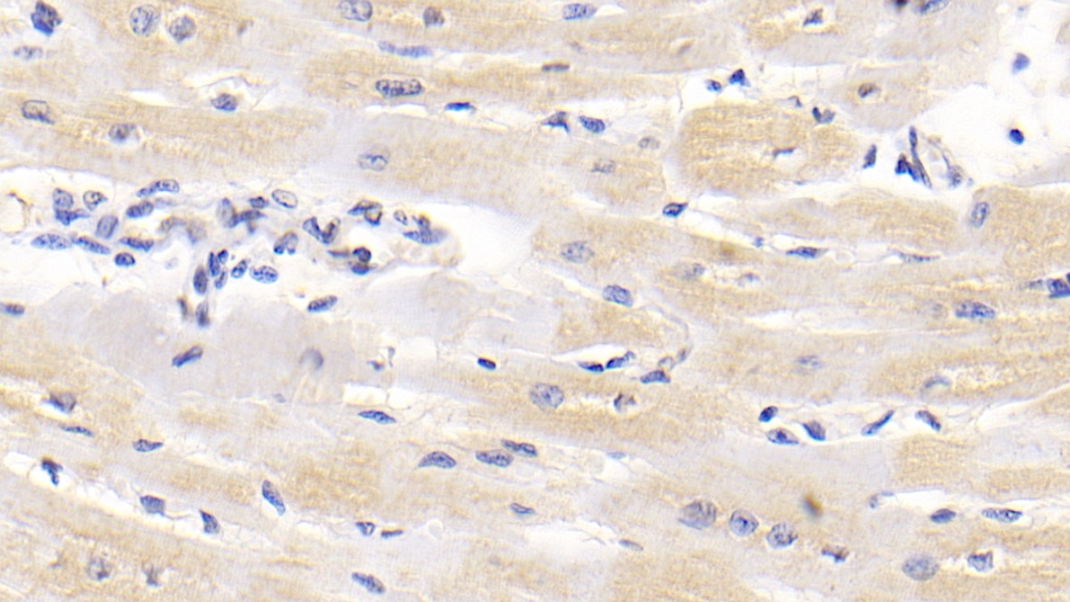 Monoclonal Antibody to Lipolysis Stimulated Lipoprotein Receptor (LSR)