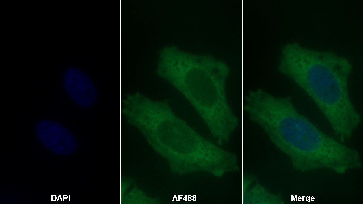 Monoclonal Antibody to Lipolysis Stimulated Lipoprotein Receptor (LSR)