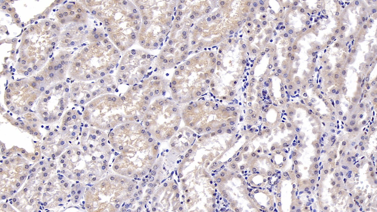 Monoclonal Antibody to Deoxythymidylate Kinase (DTYMK)