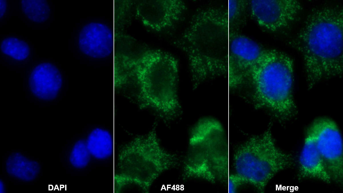 Monoclonal Antibody to Deoxythymidylate Kinase (DTYMK)