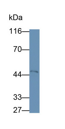 Monoclonal Antibody to Metallothionein 1E (MT1E)