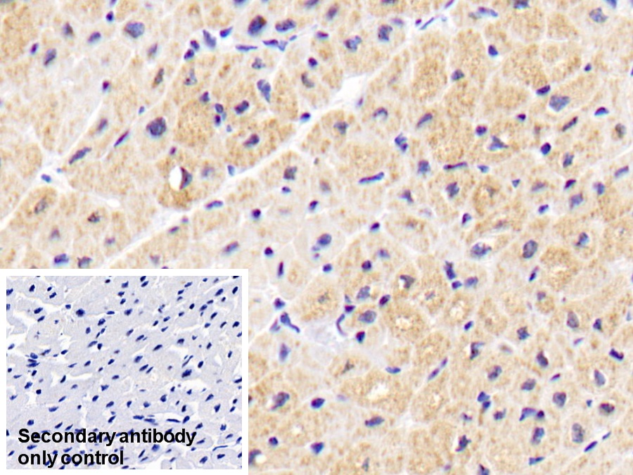 Monoclonal Antibody to Aspartate Aminotransferase 2 (AST2)