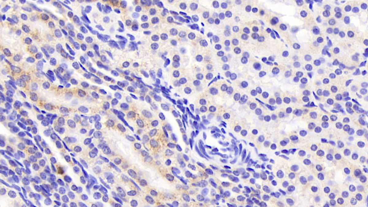 Monoclonal Antibody to Aspartate Aminotransferase 2 (AST2)