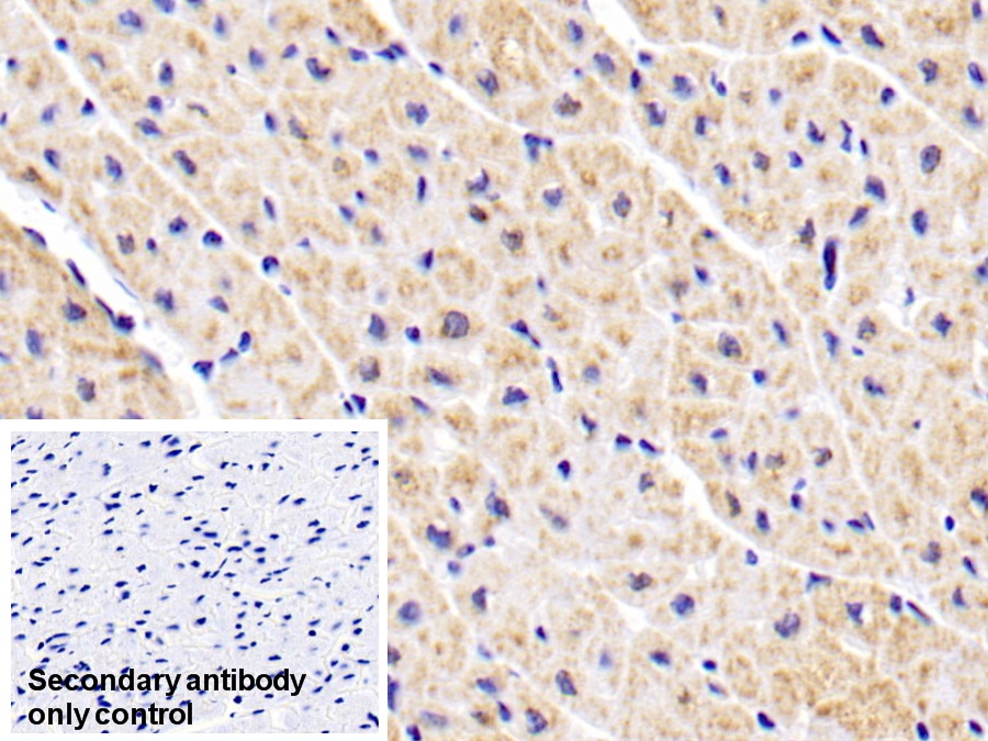 Monoclonal Antibody to Aspartate Aminotransferase 2 (AST2)