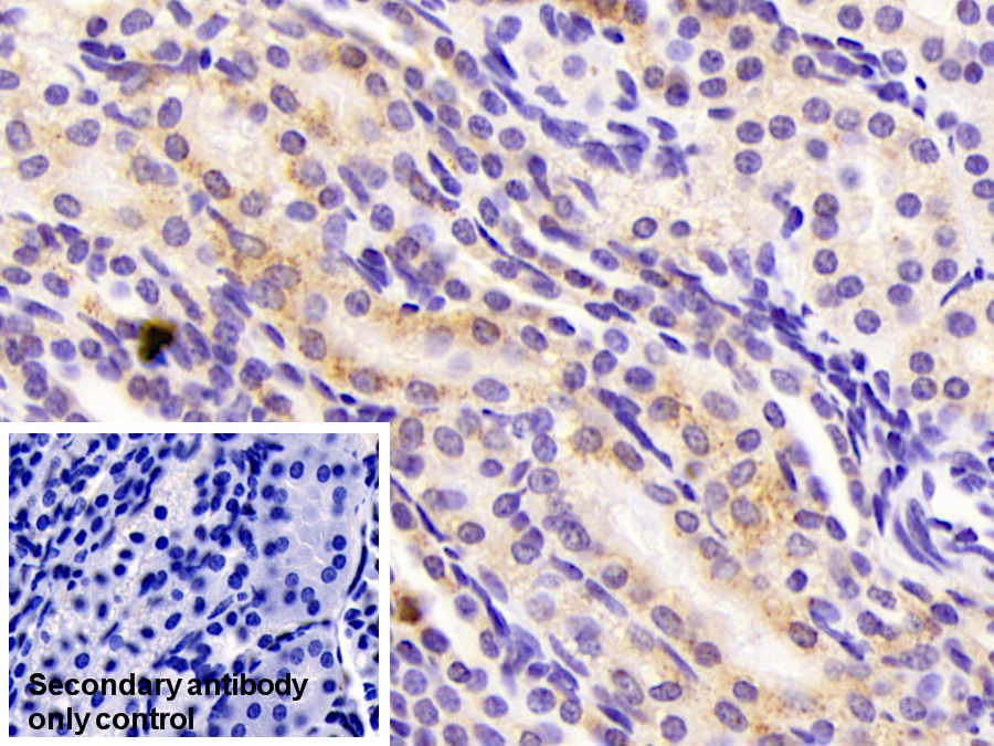 Monoclonal Antibody to Aspartate Aminotransferase 2 (AST2)