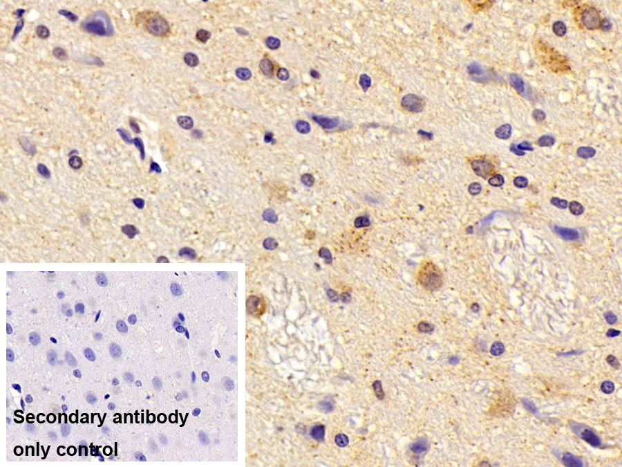 Monoclonal Antibody to Aspartate Aminotransferase 2 (AST2)