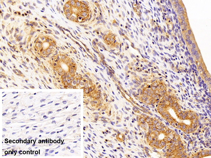 Monoclonal Antibody to Aspartate Aminotransferase 2 (AST2)