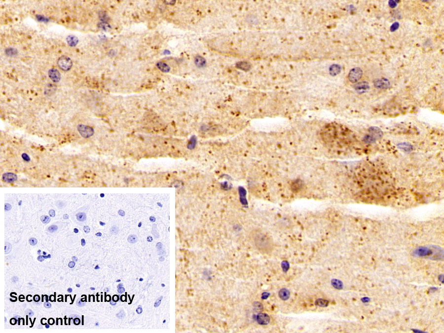 Monoclonal Antibody to Aspartate Aminotransferase 2 (AST2)