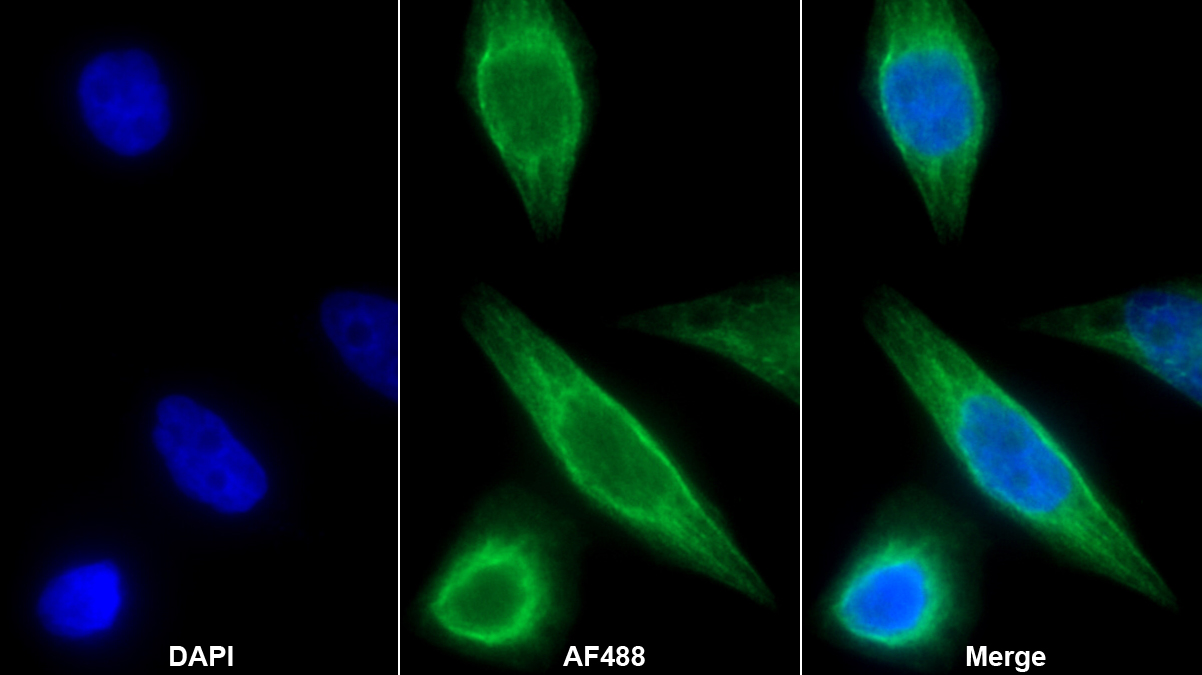 Monoclonal Antibody to Aspartate Aminotransferase 2 (AST2)